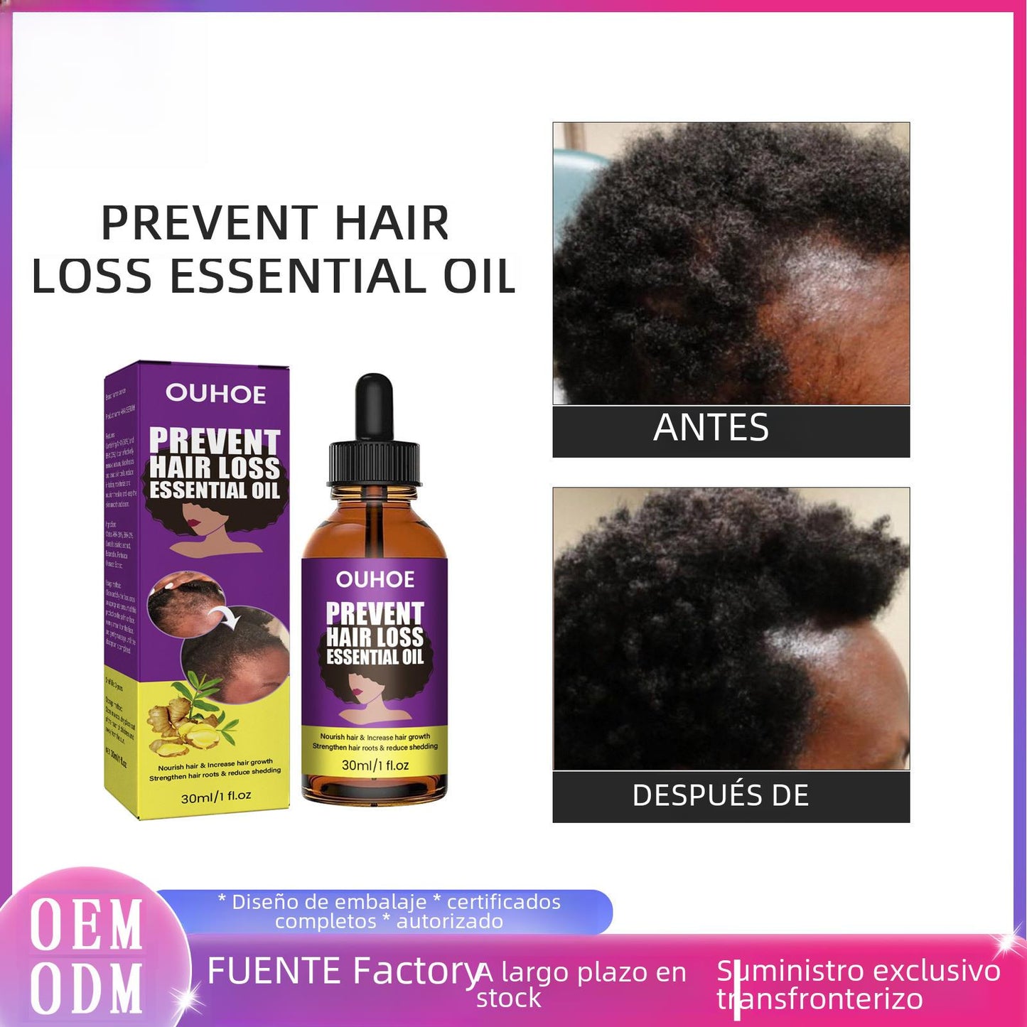 OUHOE anti-hair loss essence strong hair hair anti-hair loss solid hair fluffy hair moisturizing hair care essence